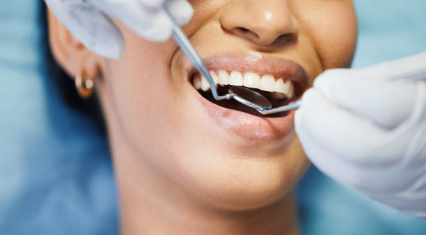 Best Emergency Root Canal Treatment in Cowarts, AL